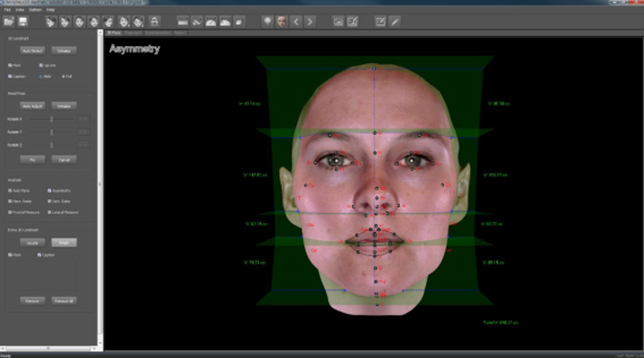 3D안면측정 이미지2